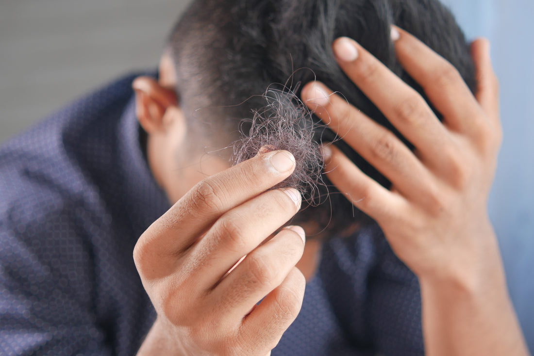 Can Herpes Cause Hair Loss?